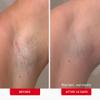 First Aid Beauty - Ingrown Hair Pads with BHA + AHA - Aftershave Treatment Pads to Help Prevent Razor Bumps for Men & Women - Exfoliate Underarms & Bikini Area - Compostable for Daily Use - 28 Pads view 3