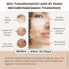 Glow Microdermabrasion Polish: Anti Aging (Natural Vitamin C, Salicylic Acid, Enzymes, AHAs) Deeply Exfoliates Dull-Dry Skin to Glowing-Radiant-Smooth Texture. Tightens Pores-Wrinkles-Botanic Visage view 2