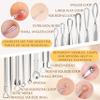 16 Pcs Blackhead Remover Tools Surgical Stainless Steel 410 | Pimple Popper Tool Kit | Stainless Steel Professional Pimple Extractor Tool Kit for Blackheads, Comdone, Acne, Zit, and Whiteheads view 3