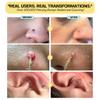 BASE LABORATORIES Piercing Bump Solution & Keloid Bump Removal | Soothing Piercing Aftercare for Piercing Bumps & Keloid Scar Removal | Ear & Nose Keloid Bumps Piercing Aftercare Solution Oil | 0.5 oz view 4