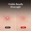 MIZON Good Bye Blemish Clear Patch Invisible Korean Acne Pimple Covering Zits Waterproof Non-drying Thin Cover Excellent Skin Adhesion Patch Spot Cover (44ea) view 4