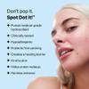 Peach Slices - Acne Spot Dots (60 ct) - Hydrocolloid Pimple Patches for Face - Absorb Gunk, Protect Picking & Support Healing - 3 Sizes (7, 10, & 12mm) - Vegan, Cruelty Free, Korean Skin Care & Beauty view 2