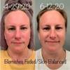 Lavender Calendula Facial Serum view 3