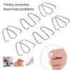 ZJchao Ingrown Toenail Corrector Tools, Nail Bunion Corrector Ingrown Toe Nail Wire Lifter Fixer Recover for Curved Toes & Swollen Cuticles view 4