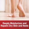 Kerasal Nighttime Intensive Foot Repair, Skin Healing Ointment for Cracked Heels and Dry Feet, 1 oz (Packaging May Vary) view 4