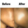 3-Step Skincare System (Cooling Peppermint Facewash) view 3