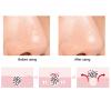 Nose Cleaning Tool, Nose Cleansing Brush Blackheads Cleaning for Home for Beauty Salon for Women(orange) view 4