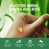 Aloe Vera Gel - With Organic Aloe Vera Cold Pressed and Tea Tree Oil Foot Soak view 4