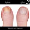 butter LONDON Illuminating Nail Concealer, Sheer Treatment, Nail Care view 4