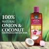 Parachute Advansed Onion Oil For Hair Growth, Blend Of Onion & Coconut Oil, Controls Hairfall & Promotes Hair Growth, 300Ml, Red view 4