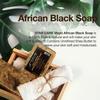 STAR CARE 100% Virgin African Black Soap with Unrefined Shea Butter  Natural Face & Body Cleanser for Clear, Healthy-Looking Skin  Traditional African Skincare (16 oz) view 2