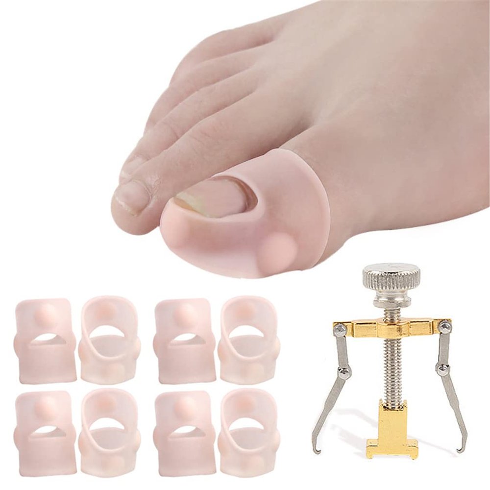 Elastic Silicone Ingrown Toenail Correction Sleeves, Stainless Steel Ingrown Toenail Corrector Ingrown Toenail Lifter, Big Toe Sleeves Foot Care Toe Protector Paronychia Treatment Pedicure Tool Set