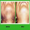 deal Hair Removal Ponnatharam Powder (25 g) view 3