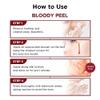 SKIN1004 Bloody Peel 1.01 fl.oz, 30ml AHA 17% Peeling Solution, Pulls off Dramatic Exfoliation Effect with Special Home-care view 3
