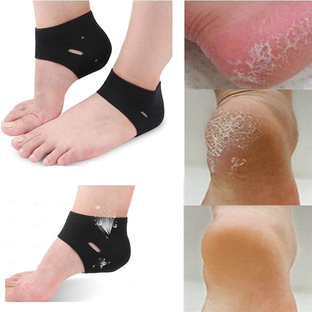 Moisturizing Socks for Cracked Heels - Moisturizing Heel Sleeves smooths and softens Rough and Cracked Heels and Heel Cracks, chapped Heels, Callous feet (2 Pairs).