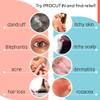OZIDEX Procutin Spray for Skin Demodex and Surface Care | 2in1 Formula view 3