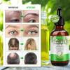 ALIVER Rosemary Essential Oil for Hair Growth, Enhanced Shine, 100% Pure Natural, Nourishment Scalp, Improves Blood Circulation, Best Serum for Skin, 2.02 fl oz view 4