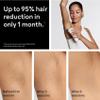Braun IPL SilkExpert Pro 5 PL5157 Latest Generation IPL, Permanent Visible Hair Reduction, Holiday Gifts for Women and Men, at-Home Hair Removal System with Soft Pouch and Precision Head view 3