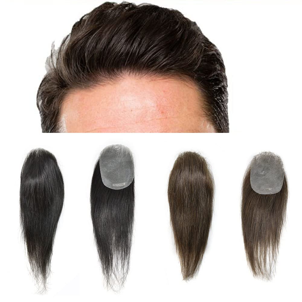 Healthlif Thin Skin V-Looped Bald Spot Hair Patch - Natural Remy Human Hair Replacement Unit - Transparent Skin Toupee System (4# Medium Brown, 6'')