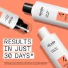 Nioxin System Kit 4 + Thickening Spray, For Color Treated Hair with Progressed Thinning, Full Size (3 Month Supply) view 2