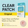 DERMA ANGEL Ultra Invisible Acne Patches for Cystic Acne Treatment Pimple Patches for Cystic Acne Blemish Patches Hydrocolloid Patches - Day & Night Use - UPGRADED (Acne Specialist 120 Count 3 Sizes) view 4