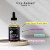 Little Miracle Preggo Belly Oil (Enchanted Elixir) for Pregnancy Stretch Marks and Itching view 2