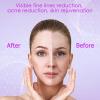 YourMate PhotoTherapy Device High Frequency Facial Wand Machine with Argon Tubes for Face Chin Neck Hair, Facial Skin Wand Machine with 4 Different Tubes view 4