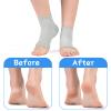 DCC-GETS Moisturizing Socks For Cracked Feet Women-2 Pairs-Gift Of Spa Gel Socks Cracked Heel Treatment (Black) view 2