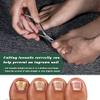FVION Toenail Clipper Straight Blade, Professional Toe Nail Clipper for Senior, Ingrown Toenail Tool for Thick Ingrown Nails view 2