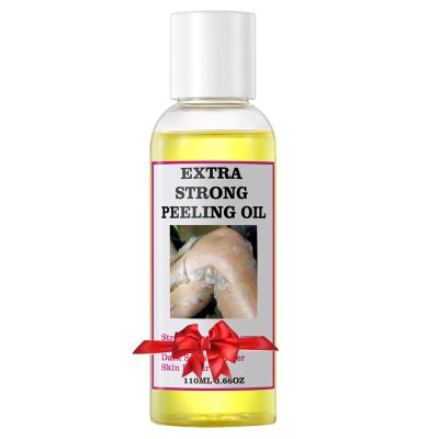 YAFUSIPE Yellow Peeling Oil for Dark Skin Strong Peel Oil Extra Strength Exfoliating Chemical Exfoliant Peels Solution at Home Body Peeling for Exfoliate Body Hand Foot Knuckle All Skin Type 3.66 OZ