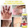 YAFUSIPE Yellow Peeling Oil for Dark Skin Strong Peel Oil Extra Strength Exfoliating Chemical Exfoliant Peels Solution at Home Body Peeling for Exfoliate Body Hand Foot Knuckle All Skin Type 3.66 OZ view 2