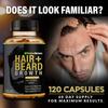 Hair + Beard Growth Vitamins for Men | Biotin 10,000mcg, Collagen, Patented OptiMSM, goMCT, Saw Palmetto | 60 Day Supply | Naturally Regrow Stronger, Thicker, Healthier Hair & Stops Hair Los view 3