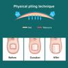Feilx Manicure Set Professional Nail Clipper Kit- 10PCS Pedicure Tools Professional Foot Care Kit Ingrown Toenail Removal Correction Clippers Toe Nail File Lifter Nail view 4