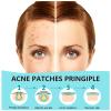 PICcircuit 180 Counts Pimple Patches for Face Hydrocolloid Acne Patches for face Invisible Zit Patches for Face Pimple Patch Acne Spot Treatment Patch Blemish Patches Cover Patches Stickers view 2
