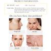 AICHUN BEAUTY Peeling Gel Face Body Removes Skin Aging Keratine Deep Cleaning Moisturizing Refresh Skin Smooth (24K PURE GOLD PEELING GEL) view 2
