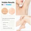 IPL Laser Hair Removal Device for Women & Men - at-Home Safe Painless Permanent Hair Reduction, 85% Hair Reduction in 4 Weeks, One-Button Control, Full Body & Face, Effective Salon Alternative view 2