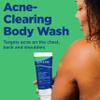 Differin Acne Body Wash by the makers of Differin Gel, Acne Treatment Cleanser with Salicylic Acid, Cream to Lather Formula for Back, Chest, Shoulders, 10 Oz. view 2