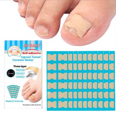 120PCS Non-Glue Toenail Patch Correction Stickers Ingrown Toenail Correction Pedicure Tool Toe Inlay Nail Corrector Nail Patch