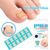120PCS Non-Glue Toenail Patch Correction Stickers Ingrown Toenail Correction Pedicure Tool Toe Inlay Nail Corrector Nail Patch view 4