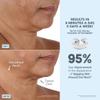 NuFACE Trinity+ Microcurrent Facial Device + Effective Lip & Eye Attachment - FDA Cleared Skin Tightening & Face Toning Device for Targeted Treatment + Microcurrent Gel Activator, Silk Crme & Brush view 4