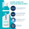 CeraVe Acne Skin Care Set, 5oz Acne Foaming Cream Cleanser + 1oz Resurfacing Retinol Serum + 2oz AM Facial Moisturizing Lotion with SPF 30 + 2oz PM Facial Moisturizing Lotion view 4