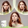 AUSLKA Blemishes Patches - 44 Strips, Hydrocolloid Dots - Large Blemishes Patch - Blemishes Stickers - Zit Breakouts - Suitable for Larger Area Outbreaks view 3