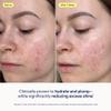 Skinfix Skin Barrier Restoring Gel Cream - 1.7 oz - Non-Greasy Moisturizer for Normal to Combination Skin - Hydrates, Plumps & Smooths - Non-Comedogenic, Fragrance Free, Vegan, Cruelty Free view 3