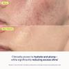 Skinfix Skin Barrier Restoring Gel Cream - 1.7 oz - Non-Greasy Moisturizer for Normal to Combination Skin - Hydrates, Plumps & Smooths - Non-Comedogenic, Fragrance Free, Vegan, Cruelty Free view 4