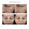 Rachel Moayer Skin Luxe Retinol with Bakuchiol 5X PM view 2