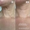 MALYS Cosmetics B-POISED Neck & Dcollet Firming Cream for Tightening and Firming - Neck Cream for Sagging Skin - Smooths The Look Of Fine Lines and Wrinkles in the Dcollet Area view 3