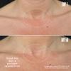 MALYS Cosmetics B-POISED Neck & Dcollet Firming Cream for Tightening and Firming - Neck Cream for Sagging Skin - Smooths The Look Of Fine Lines and Wrinkles in the Dcollet Area view 4