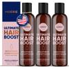 Moerie Ultimate Hair Growth Conditioner  For Longer, Thicker, Fuller Hair - Vegan Friendly Volumizing Hair Products  Paraben & Silicone Free  All Hair Types  Reverse Hair Loss  Triple Set view 1
