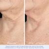 Obagi ELASTIderm Neck & Dcollet Lifting Concentrate with Patented Bi-Mineral Contour Complex, Retinoid & Alpha-Arbutin Clinically Proven to Reduce Fine Lines & Wrinkles  2 oz view 4