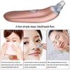 NCRD Blackhead Remover Pore Vacuum Cleaner Acne Comedo Extractor USB Rechargeable Blackhead Suction Tool with 4 Probes for Blackhead Whitehead Acne Removal view 4